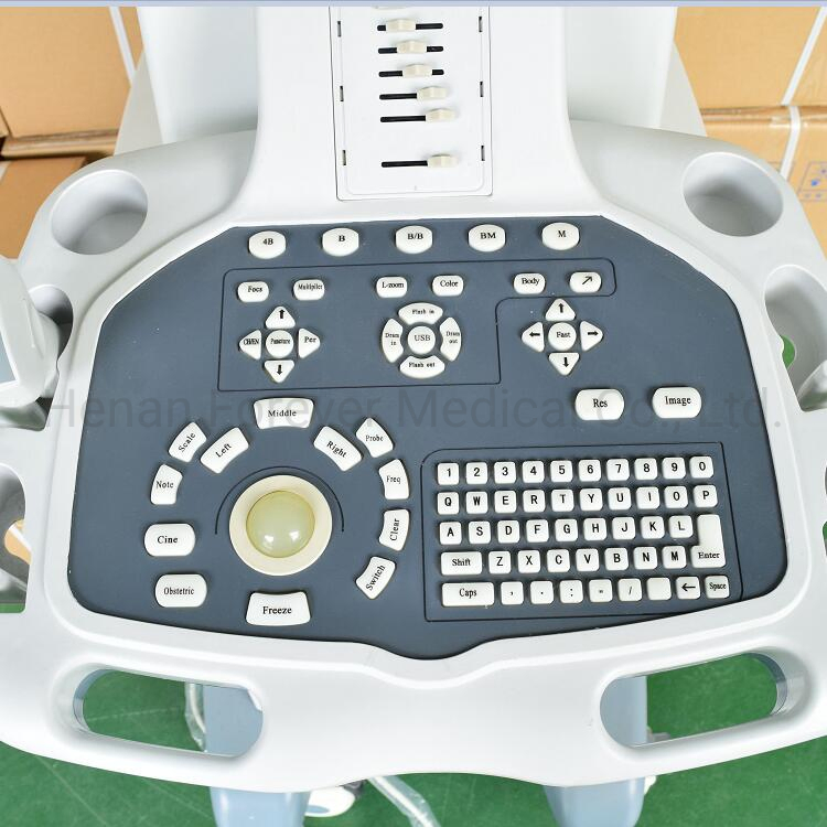 Digital Trolley Diagnostic Scanner Ultrasound System