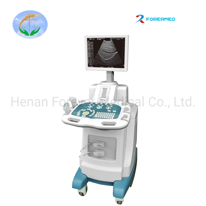 Digital Trolley Diagnostic Scanner Ultrasound System