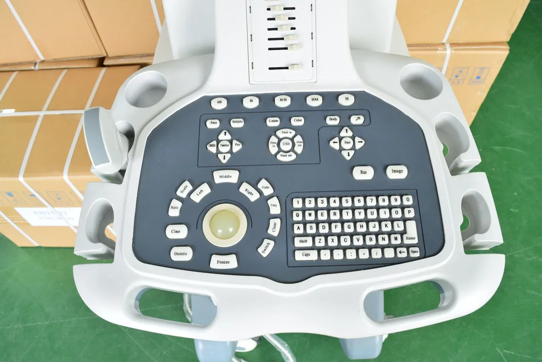 Digital Trolley Diagnostic Scanner Ultrasound System