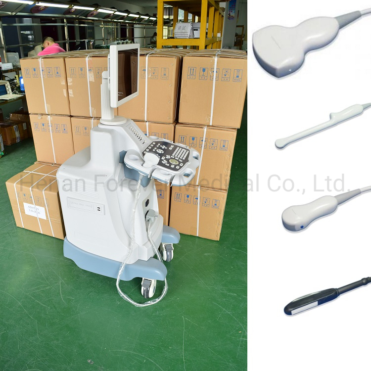 Digital Trolley Diagnostic Scanner Ultrasound System