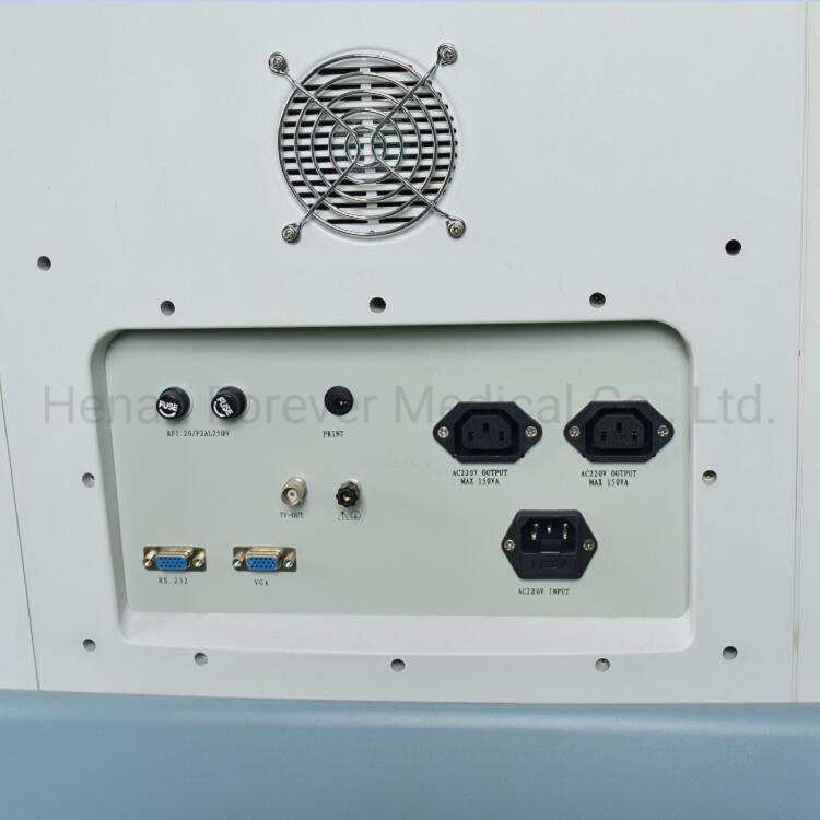 Digital Trolley Diagnostic Scanner Ultrasound System