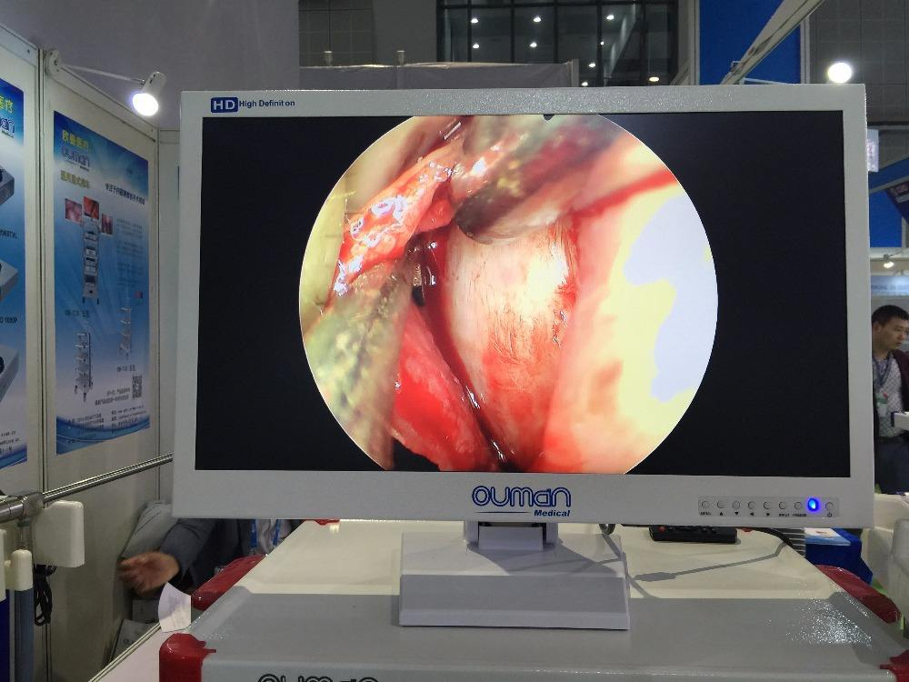 24-Inch Medical Grade LCD Endoscope Monitor