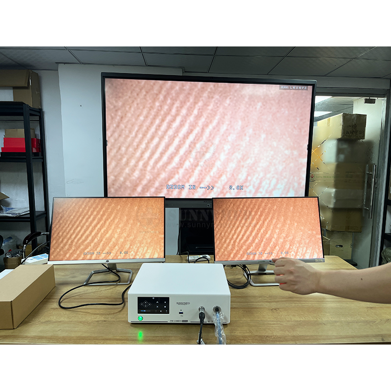 Sy-P032 High Quality Medical Grade Monitors 1080P 24/32 Inch Full HD Medical Monitor for Endoscopy System