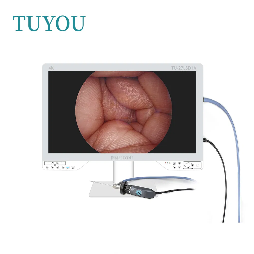 New Arrival UHD 4K Surgery Medical Grade Monitor with Light Source and Camera