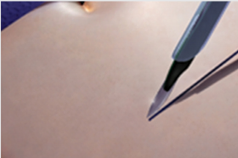 Wound Retractor Step 1