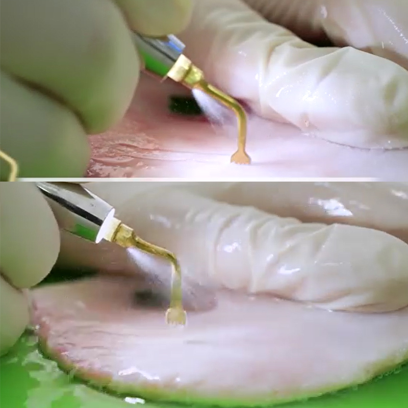 Ultrasonic Piezo Bone Scalpel Dental Surgery Ent Ultrasonic Surgical System