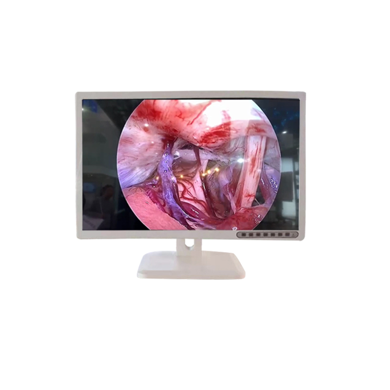 21 Inch/24 Inch/ 27 Inch/ 32 Inch 4K Medical Grade LCD Monitor for Laparoscope