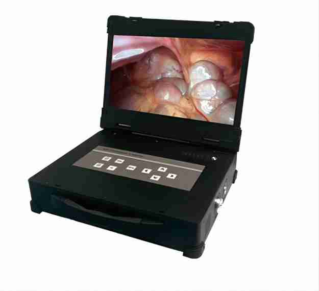 Cold Light Source for Endoscopic Imaging