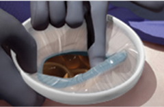 Wound Retractor Step 6