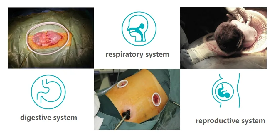 Surgical Applications