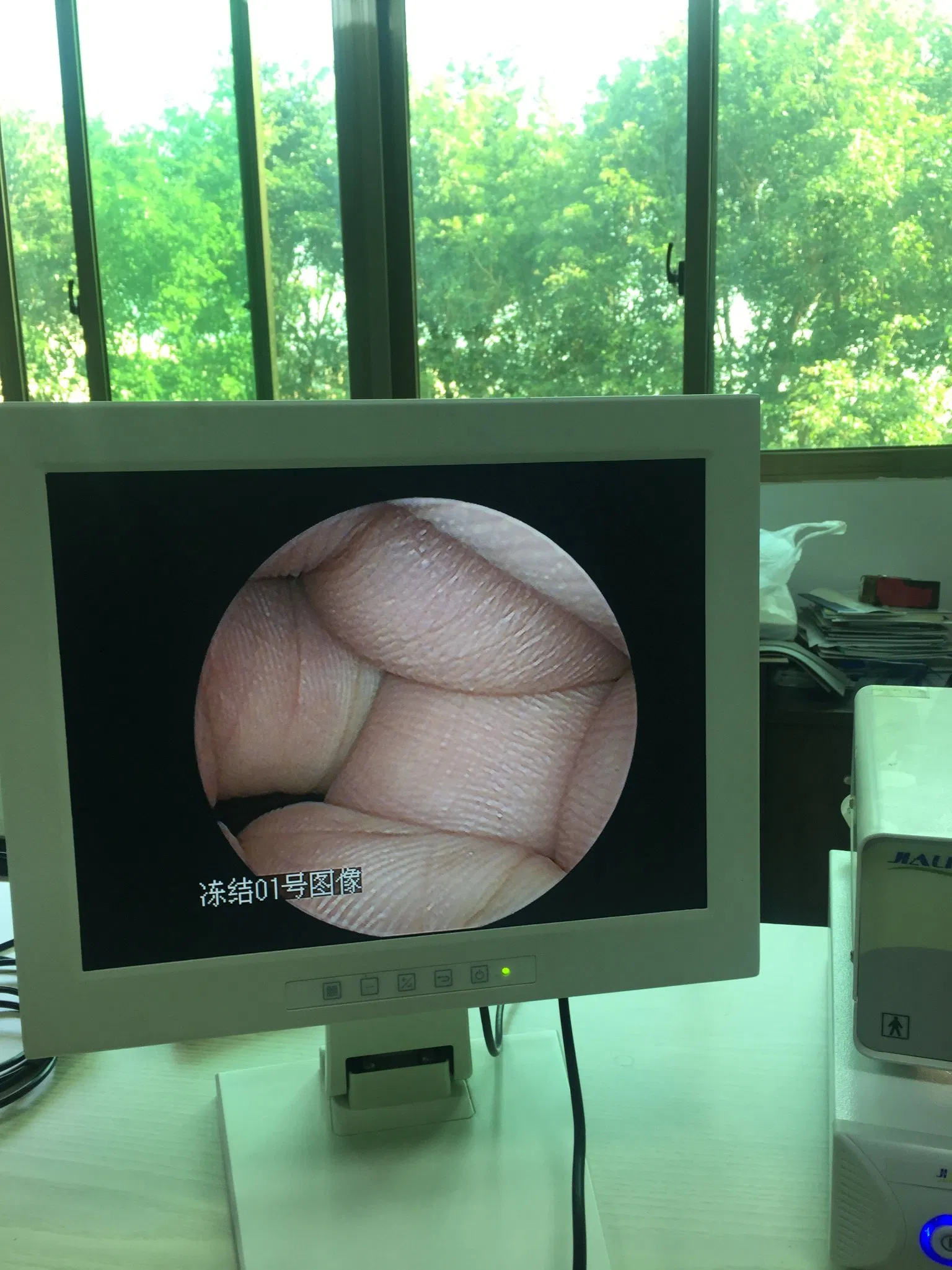 Portable LCD 15 Inch Monitor Medical Grade Monitor Connects with HD Endoscopy Camera Unit for Surgery