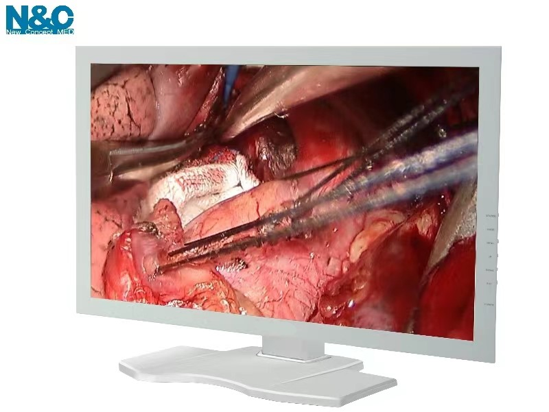 24 Inch Medical Grade Full HD Endoscope Monitor for Ent