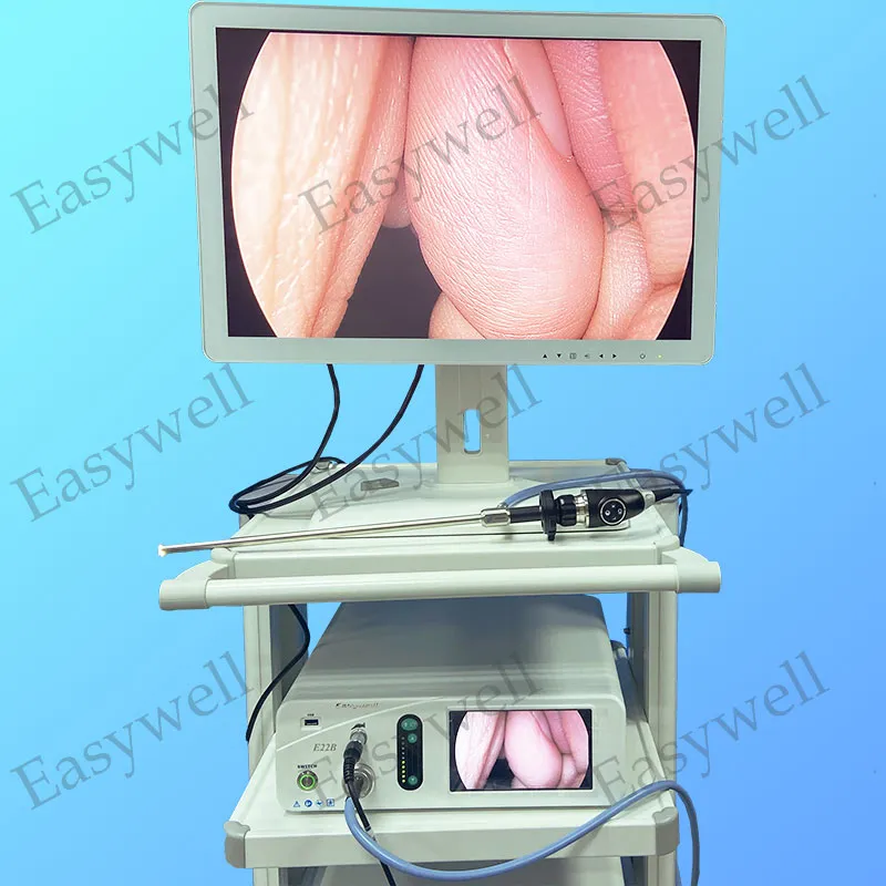 System with trolley 1