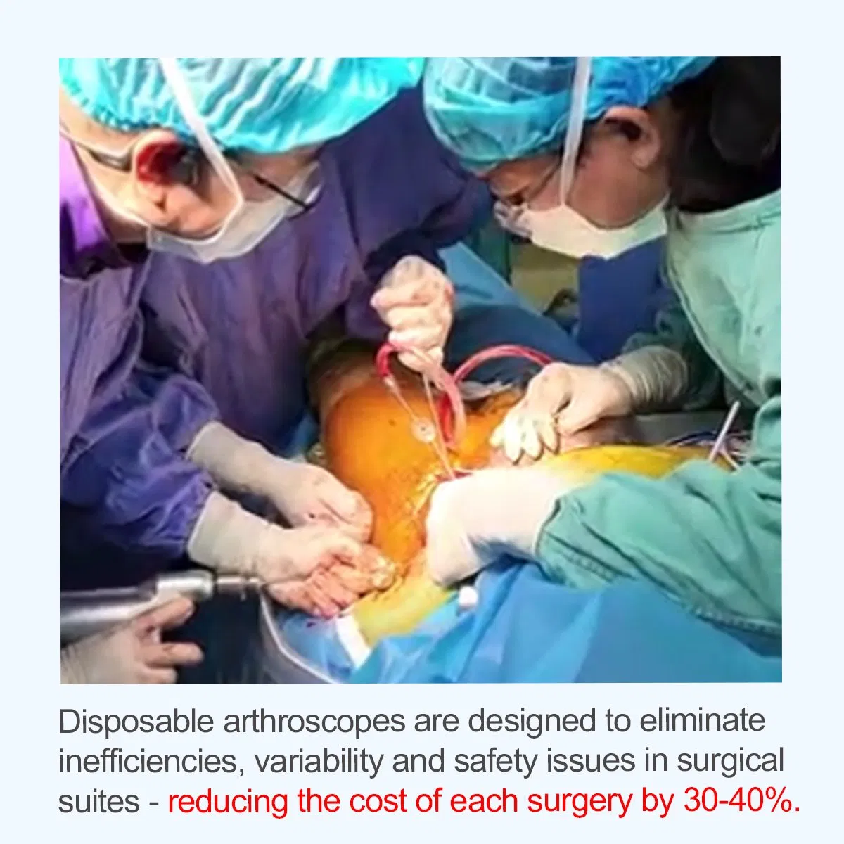 Full Endoscope Camera System Video Endoscopic Laparoscopic and Arthroscopic Ent Surgery Built in Light Source