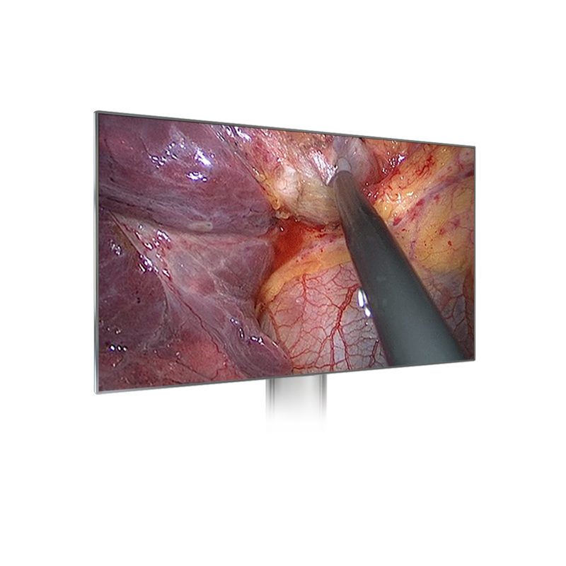 55'' Medical Grade Monitor for Laparoscope Tower with CE Certificate