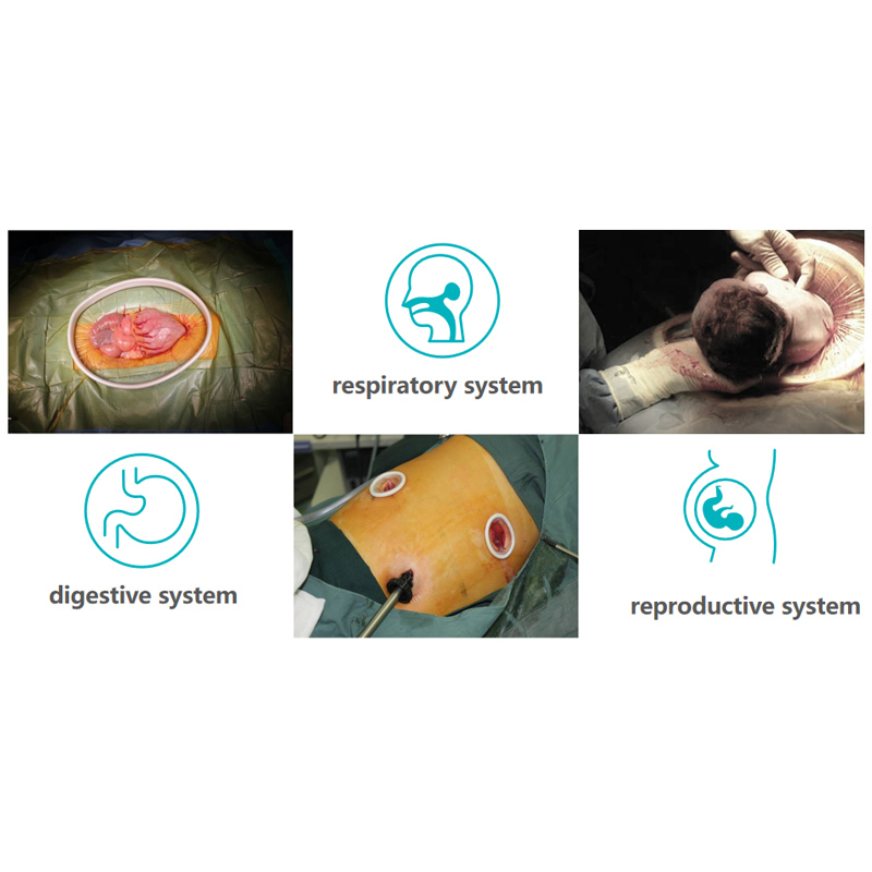 Disposable Incision Protection Sleeve Wound Protectors/Retractors