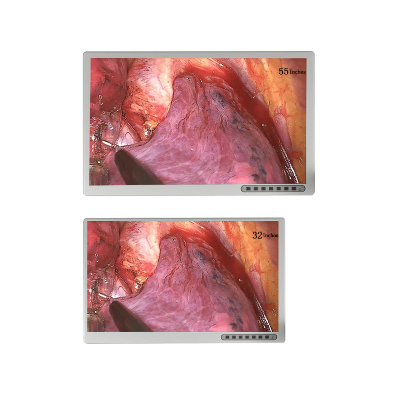 Geiwre 55-Inch 4K Medical Grade LCD Monitor for Professionals