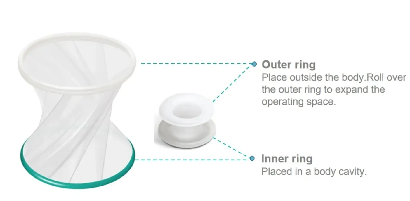 Advantages Visualization