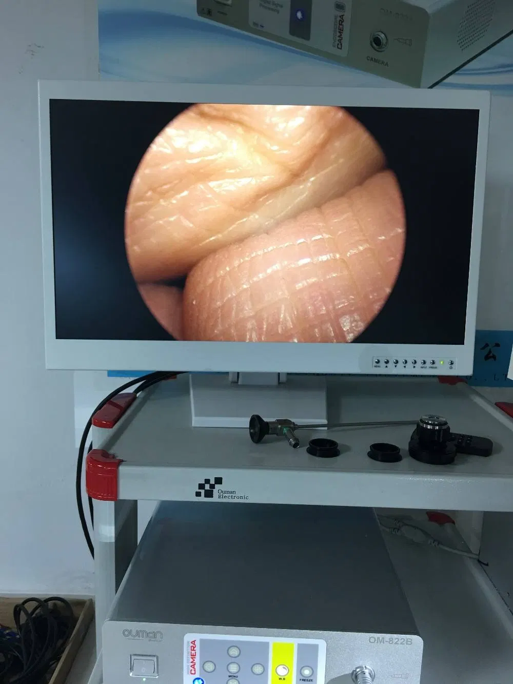 Ouman Endoscopy Camera System with Om-2410HD Medical Grade LCD Monitor