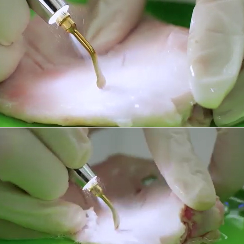 Ultrasonic Piezo Bone Scalpel Dental Surgery Ent Ultrasonic Surgical System