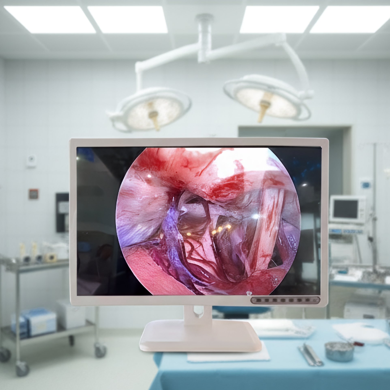4K Full HD Medical Grade Monitor for Endoscope System