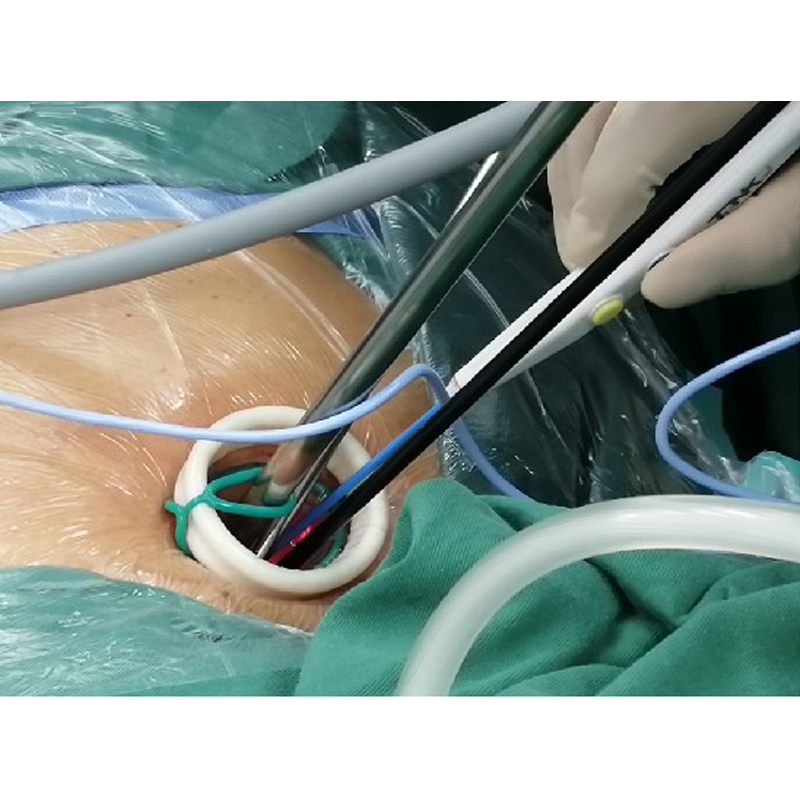 Disposable Incision Protection Sleeve Wound Protectors/Retractors