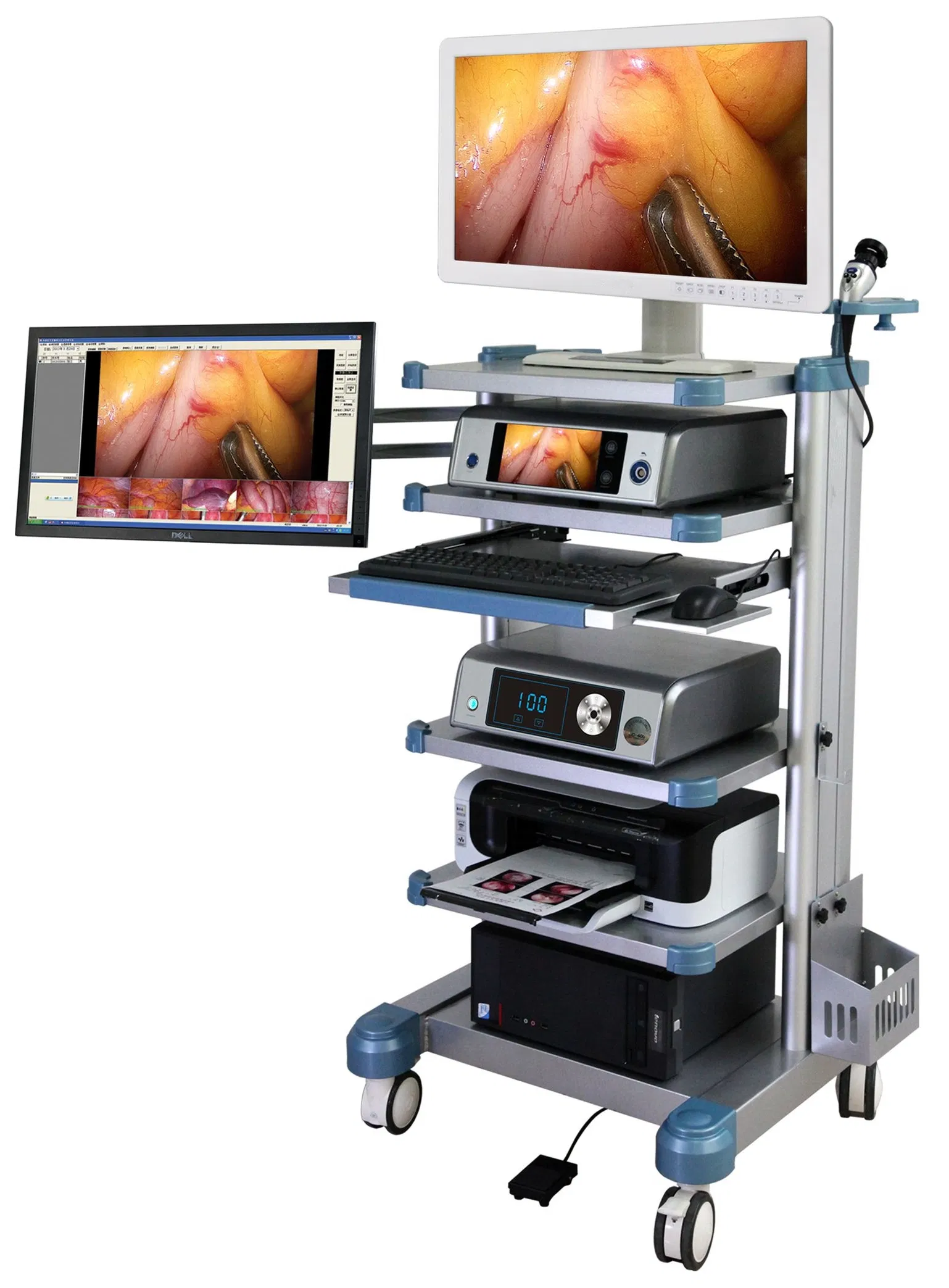 Portable LCD 15 Inch Monitor Medical Grade Monitor Connects with HD Endoscopy Camera Unit for Surgery