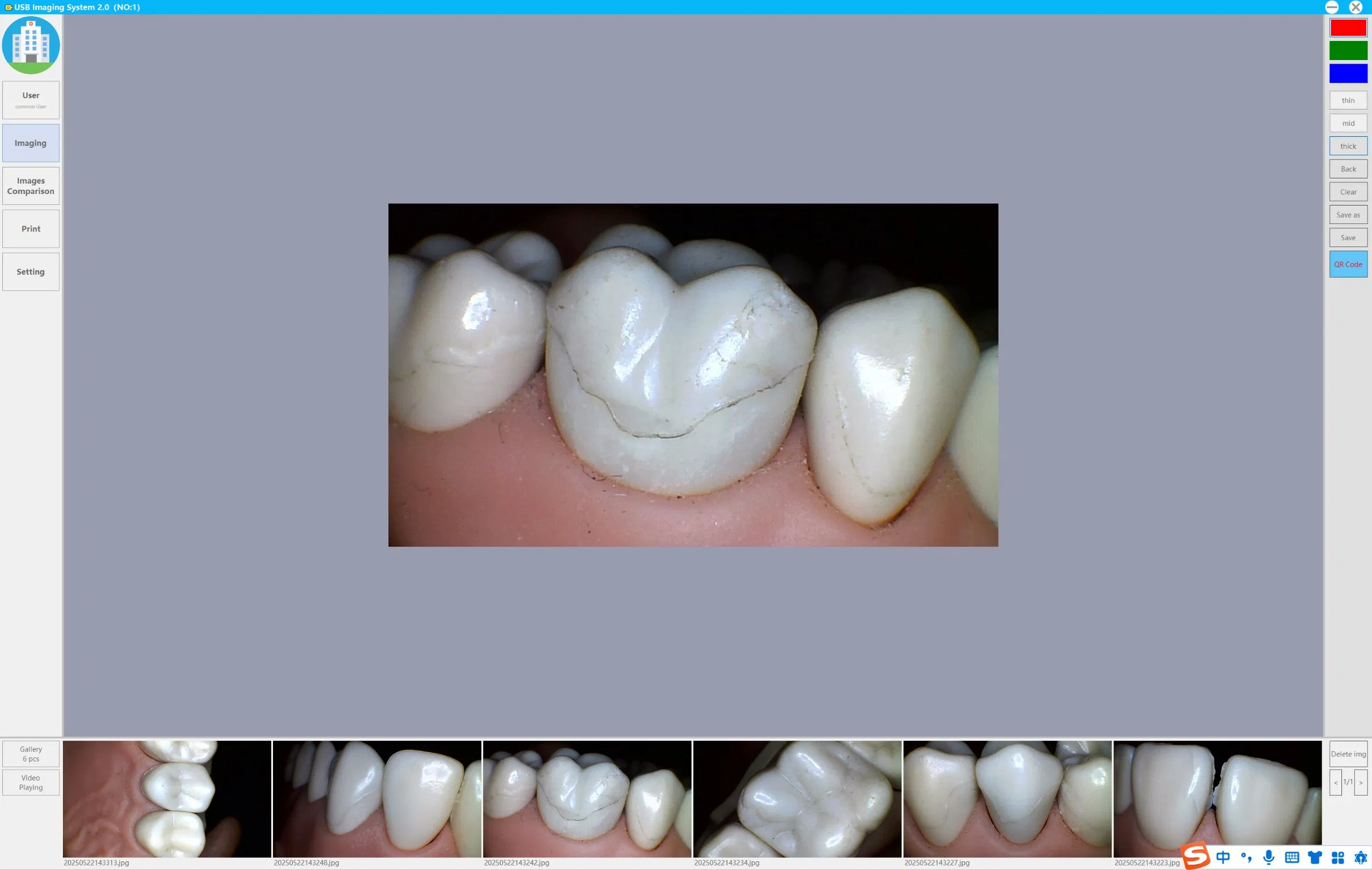 Miniature Head High-Definition Medical Intra Oral Endoscope Dental Camera for Computer Use