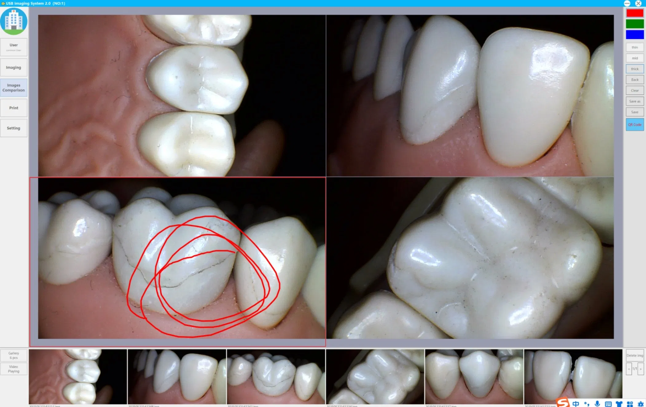 Miniature Head High-Definition Medical Intra Oral Endoscope Dental Camera for Computer Use