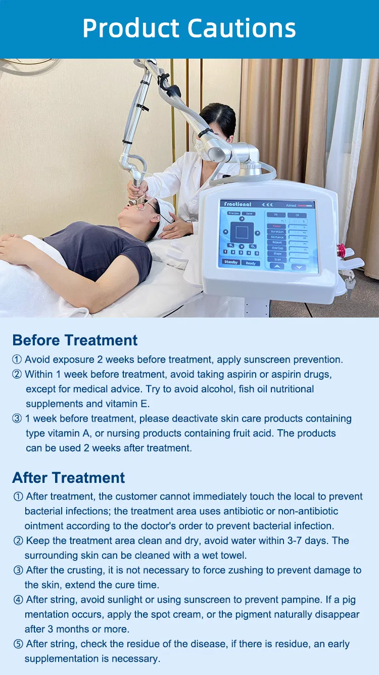 Laser Machine View 15