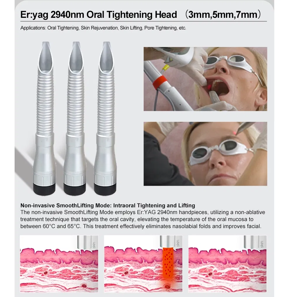 Precision Treatment Erbium YAG Laser 2940nm and ND YAG 1064nm Long Pulse Laser Face Lifting Oral Treatment Er YAG Oral Skin Rejuvenation Resurfacing