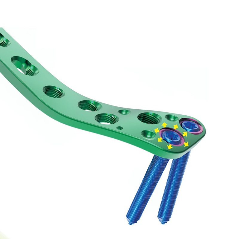 Titanium Bone Orthopedic Implants Va Locking Screw