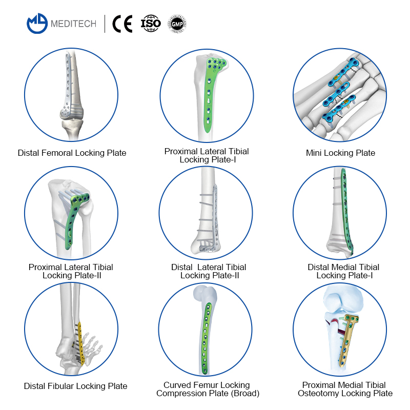Titanium-Plate-for-Bone-Fracture-Price-Philippines Plate Pure Titanium Plate Compression Sternum Locking Plate