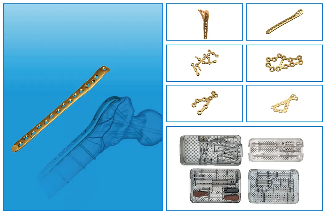 Key Features of Locking Plate
