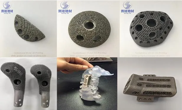3D Printing Porous Titanium Alloy Implants