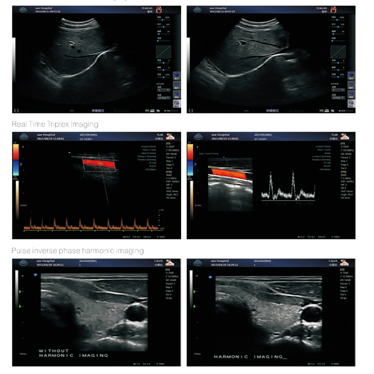 My-A031b 3D/4D Digital Color Doppler Ultrasound System