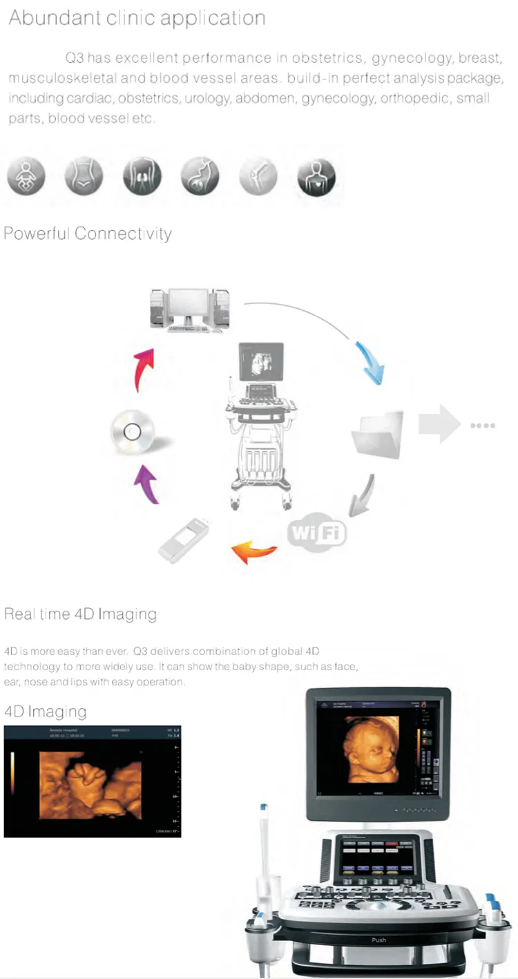 Ultrasound System View 2