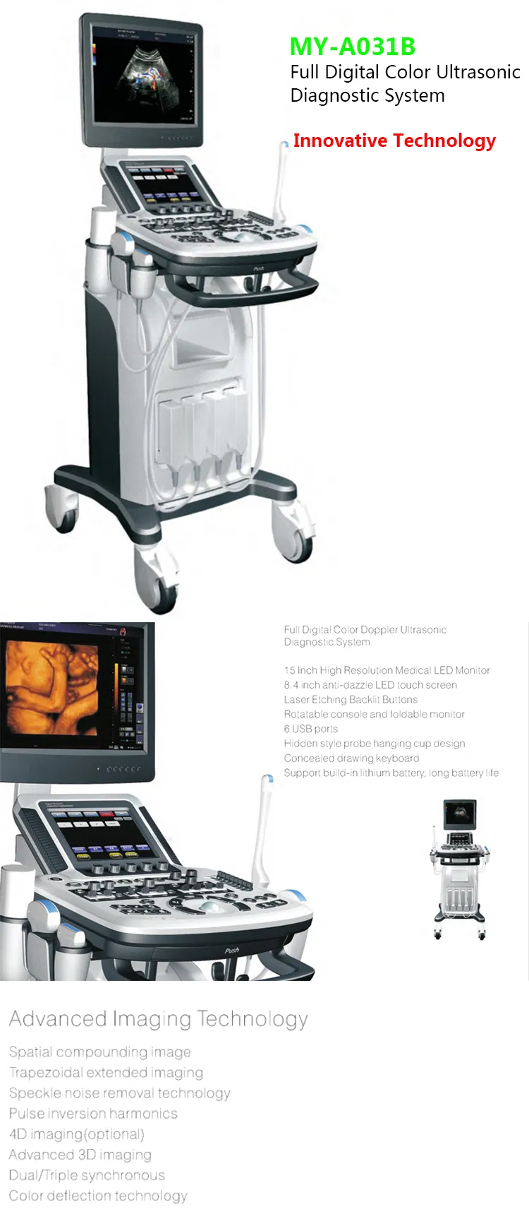 Ultrasound System View 1