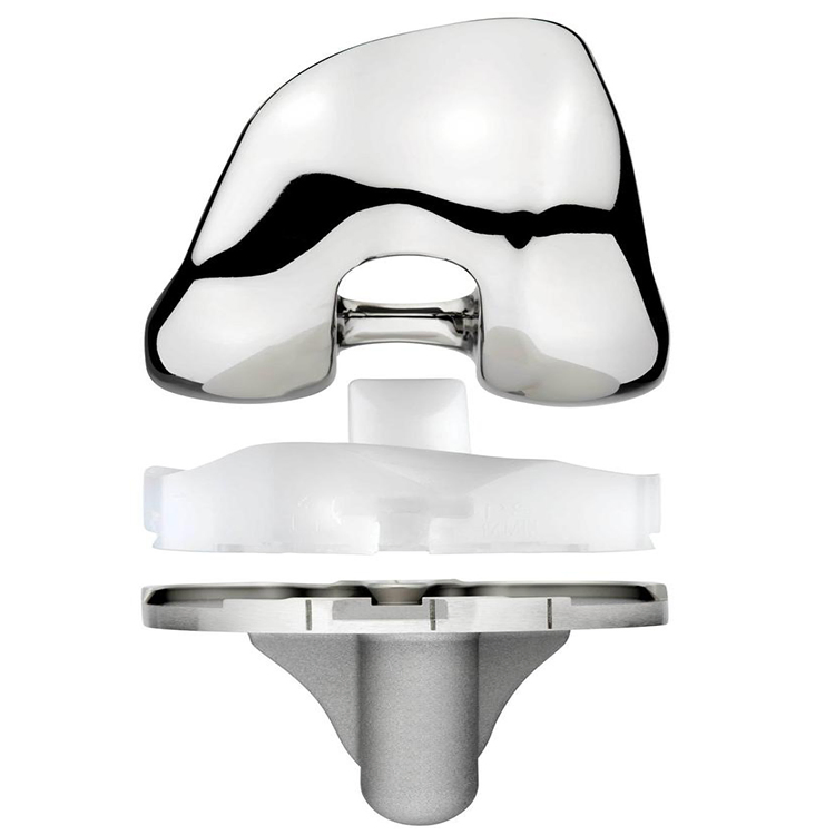 Replacement of Artificial Total Prothesis Knee Prosthesis