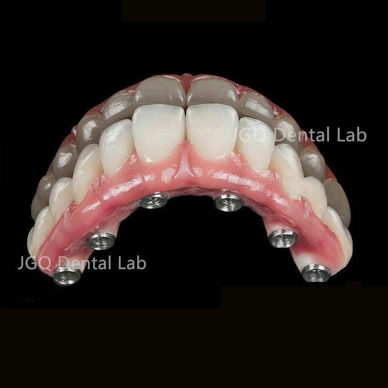 China Dental Lab Implant Product Offers Customizable Solution to Meet The Specific Needs of Each Patient