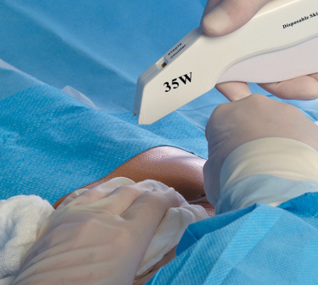 Disposable Skin Stapler and Remover Surgical Staples with CE Operation Medical Suture 15W 25W 35W