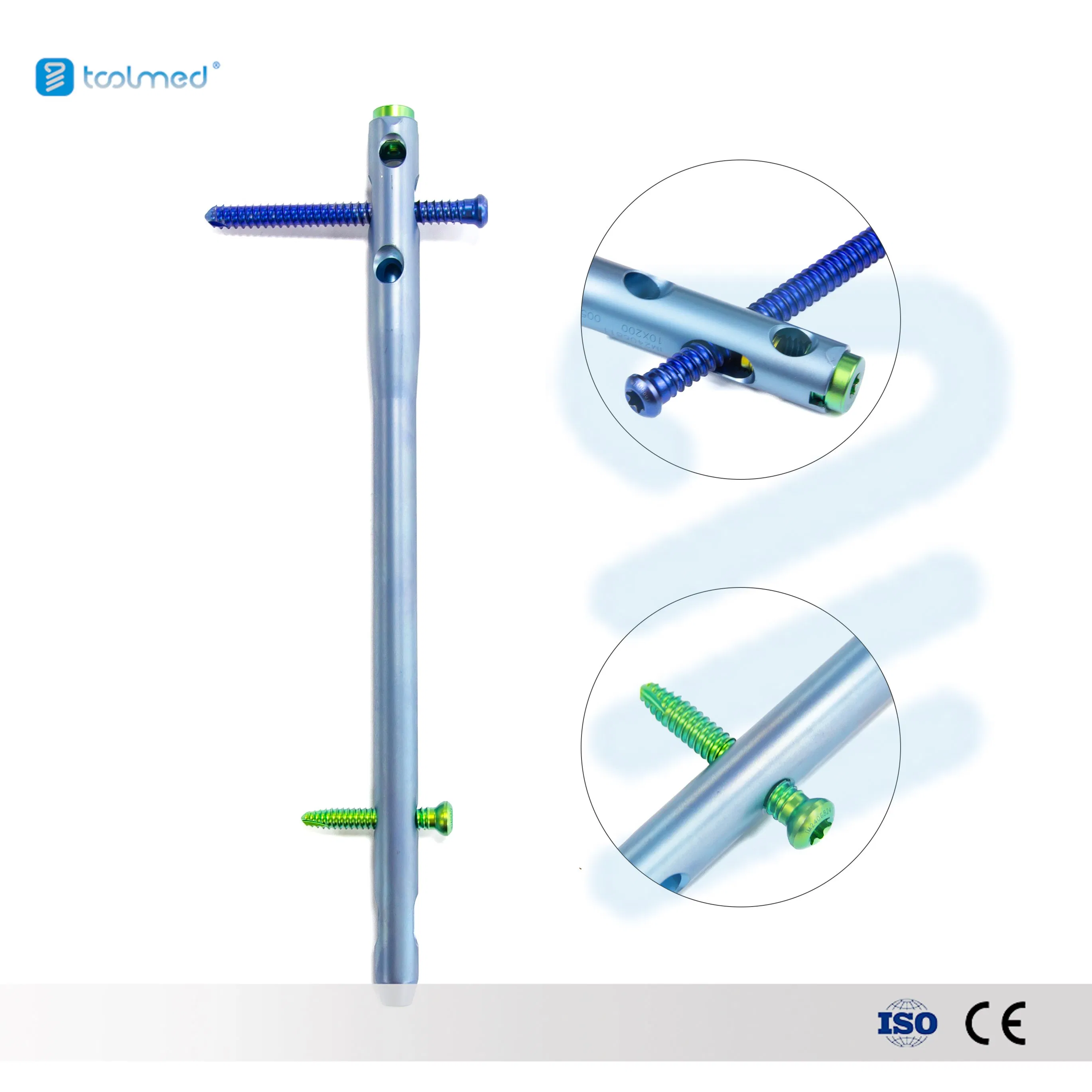 Hindfoot Fusion Ankle Nail Advanced Orthopedic Implant for Interventional Materials Orthopedic Fixation Solution