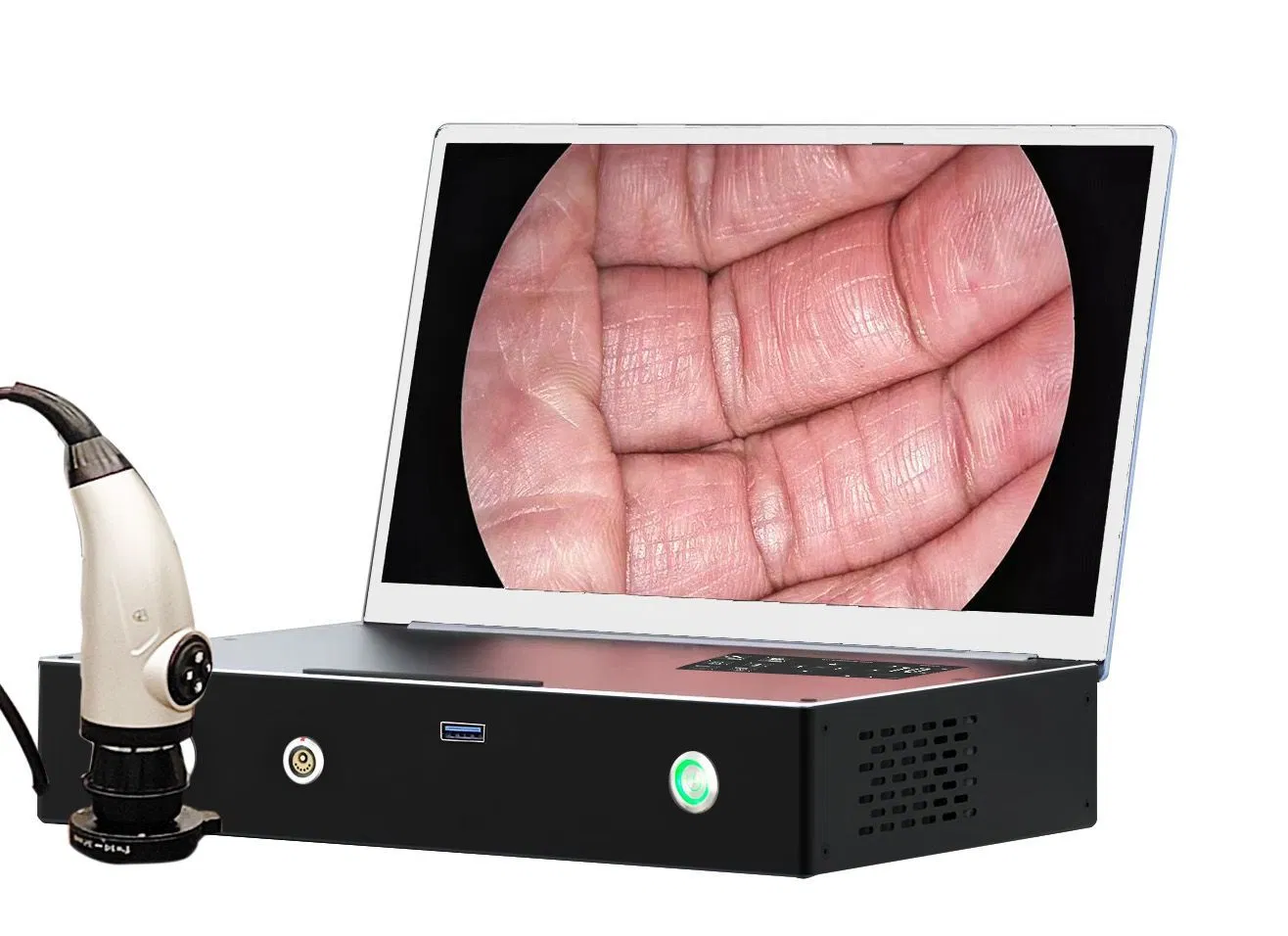 15-Inch Portable Endoscope Camera for Clinics and Mobile Use