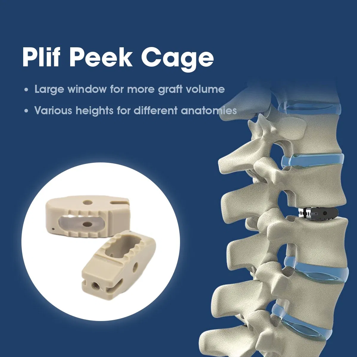 Medical Orthopedic Implantable Spinal Peek Cage Plif Tlif Olif Cage Spine Implant