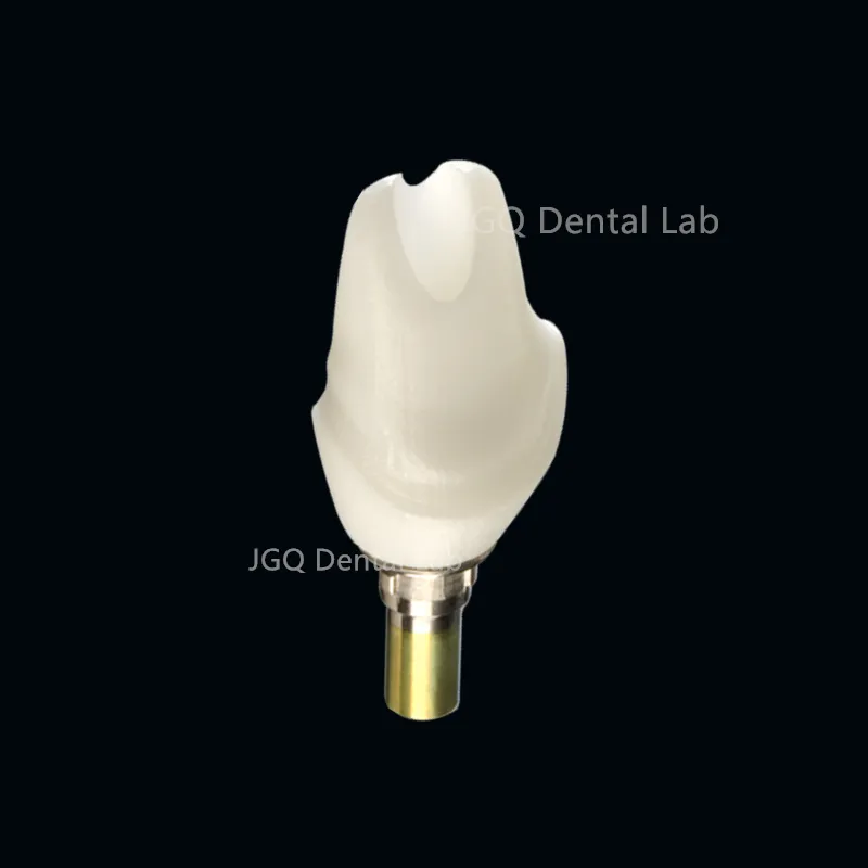 Titanium Abutment