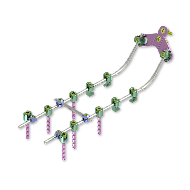 Spinelock Medical Screw Implant Bundle