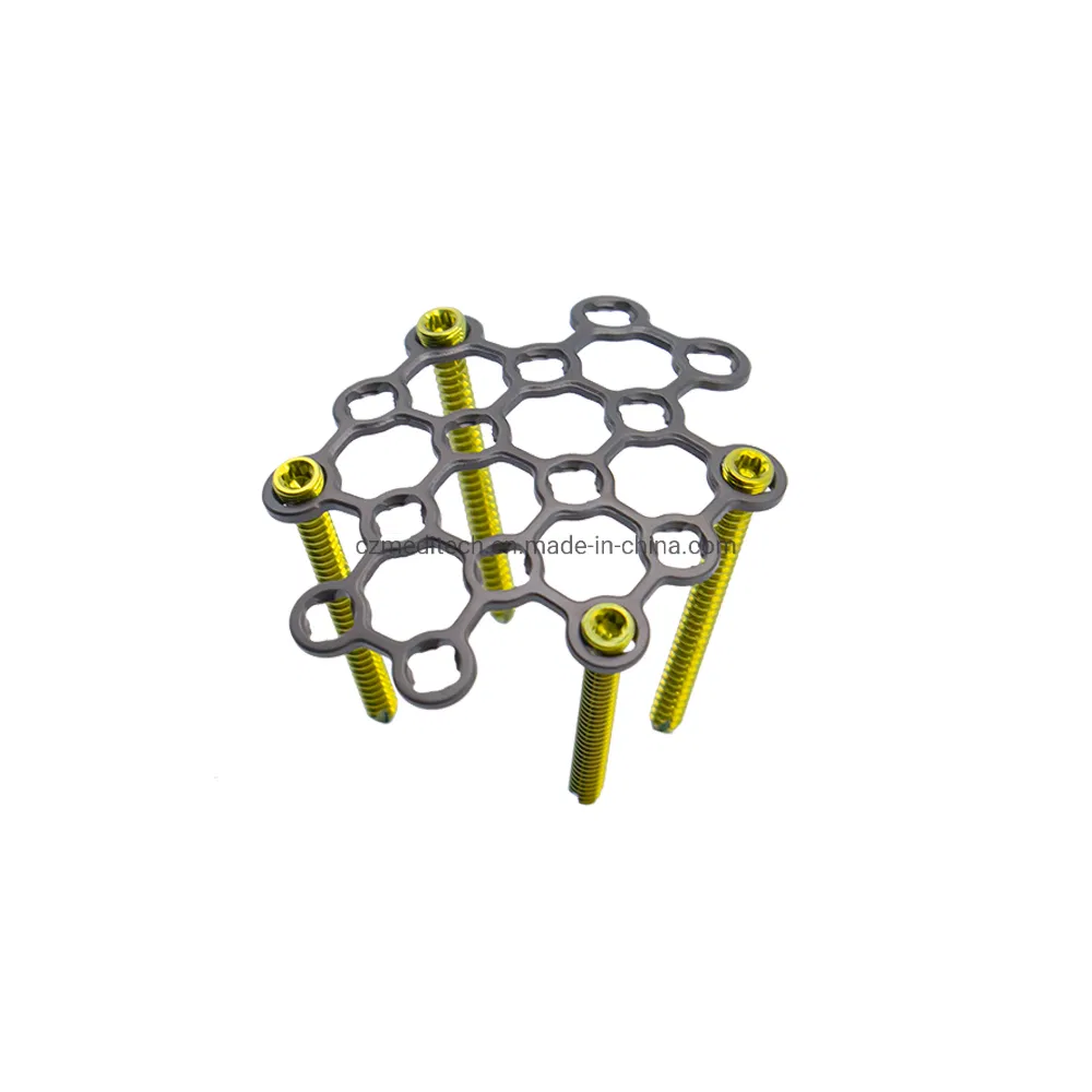 Meditech Orthopedic Surgical Implants Patella Mesh Locking Plate for Trauma Surgery