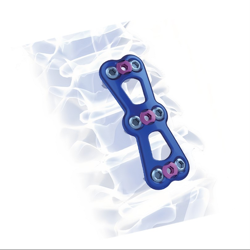 Orthopaedic Anterior Cervical Plate System Spinal Fracture Fixation Surgery Price Medical Titanium Surgical Screw Spine Orthopedic Implants