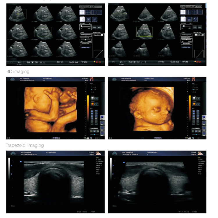 My-A031b 3D/4D Digital Color Doppler Ultrasound System