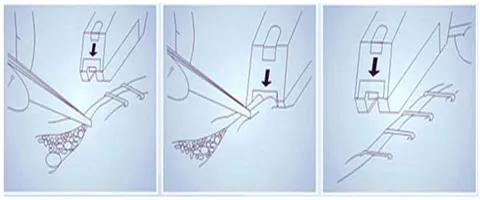 Skin Stapler Component 1